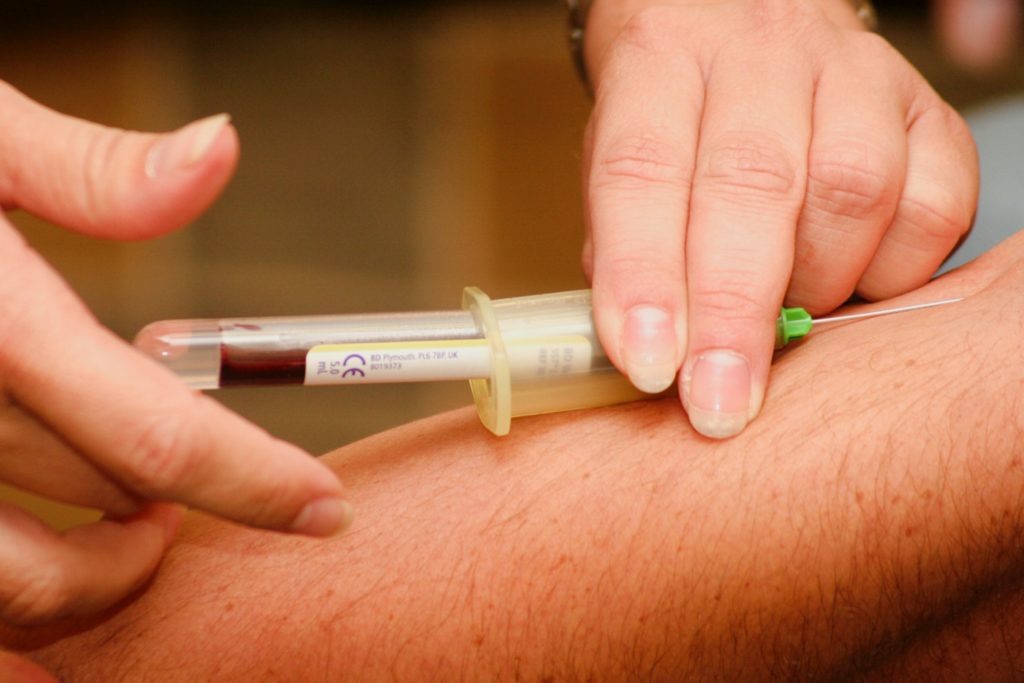 A sample of blood being taken for a prp injection