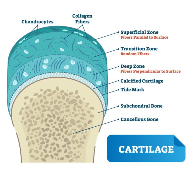 Microfracture Overview, Recovery, Rehabilitation
