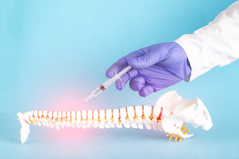 Doctor injecting a facet joint on a spine model