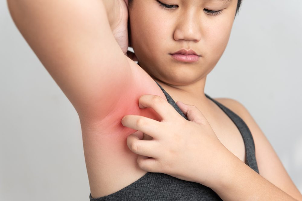 Woman Scratching her itchy arm pit at night