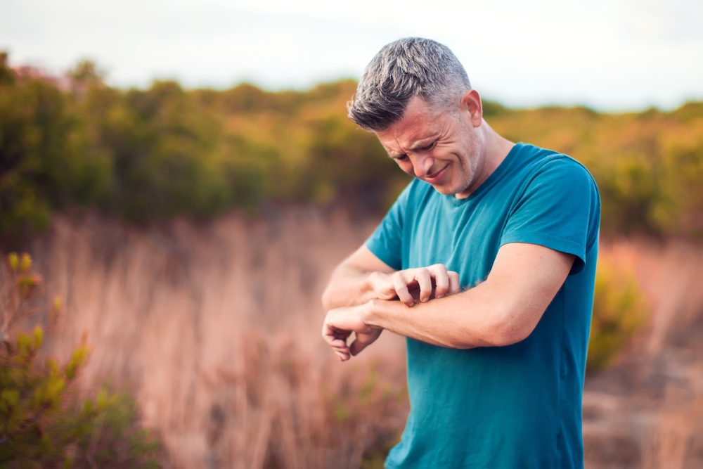 Man outdoors scartching his itchy left arm