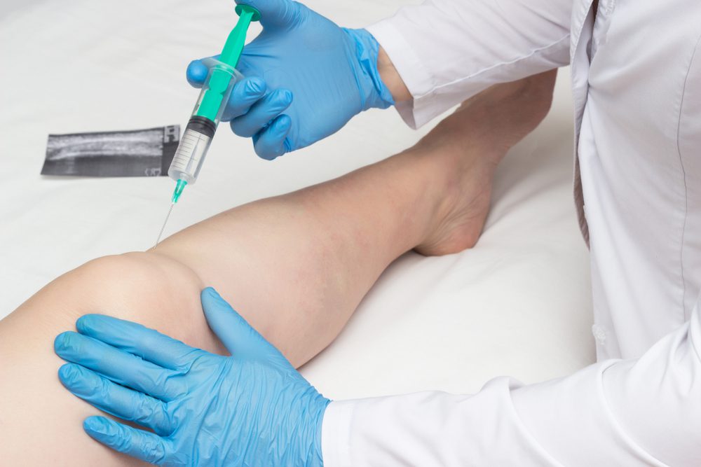 Person's leg being injected in the knee by a doctor to help them with arthritis