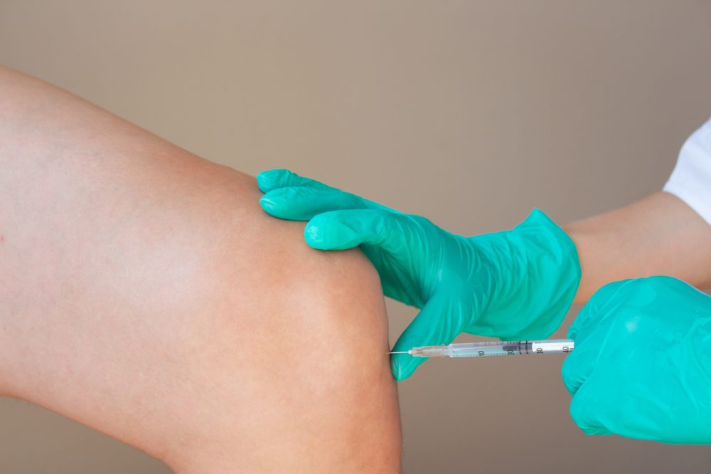 A knee with rheumatoid arthritis being injected by a doctor to help treat it