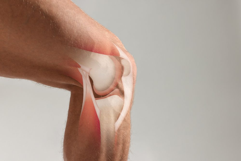 Knee cartalage Illustration of knee joint over picture of knee.